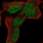 LRP1 Polyclonal Antibody