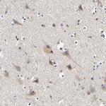 LRP1 Antibody in Immunohistochemistry (Paraffin) (IHC (P))
