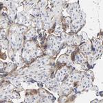 LRP1 Antibody in Immunohistochemistry (Paraffin) (IHC (P))