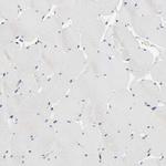 LRP1 Antibody in Immunohistochemistry (Paraffin) (IHC (P))