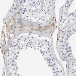 LRP1 Antibody in Immunohistochemistry (Paraffin) (IHC (P))
