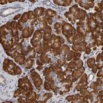 HDLBP Antibody in Immunohistochemistry (Paraffin) (IHC (P))