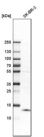 S100A9 Antibody in Western Blot (WB)
