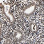 HOXA6 Antibody in Immunohistochemistry (Paraffin) (IHC (P))
