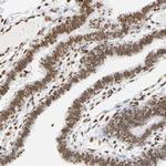 HOXA6 Antibody in Immunohistochemistry (Paraffin) (IHC (P))