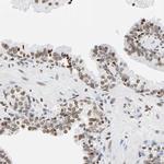 HOXA6 Polyclonal Antibody