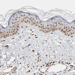 HOXA6 Antibody in Immunohistochemistry (Paraffin) (IHC (P))
