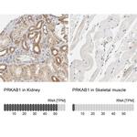 AMPK beta-1 Antibody