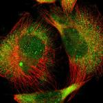 AMPK beta-1 Polyclonal Antibody