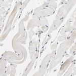 AMPK beta-1 Antibody in Immunohistochemistry (Paraffin) (IHC (P))
