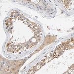 AMPK beta-1 Antibody in Immunohistochemistry (Paraffin) (IHC (P))