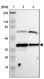AMPK beta-1 Antibody in Western Blot (WB)