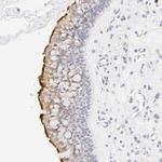 CYP4B1 Polyclonal Antibody