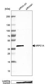 ARPC1A Antibody