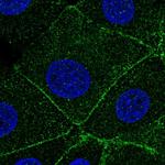 ARPC1A Polyclonal Antibody