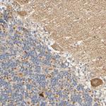 ARPC1A Antibody in Immunohistochemistry (Paraffin) (IHC (P))