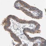 ARPC1A Antibody in Immunohistochemistry (Paraffin) (IHC (P))