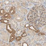 ARPC1A Antibody in Immunohistochemistry (Paraffin) (IHC (P))