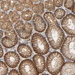 ARPC1A Antibody in Immunohistochemistry (Paraffin) (IHC (P))