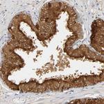 Prostate Specific Acid Phosphatase Antibody in Immunohistochemistry (Paraffin) (IHC (P))