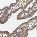IFITM3 Antibody in Immunohistochemistry (Paraffin) (IHC (P))