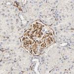 IFITM3 Antibody in Immunohistochemistry (Paraffin) (IHC (P))