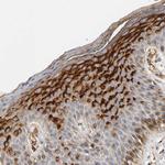 IFITM3 Antibody in Immunohistochemistry (Paraffin) (IHC (P))