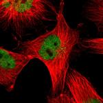 TRIM33 Polyclonal Antibody