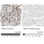 TRIM33 Antibody in Immunohistochemistry (Paraffin) (IHC (P))