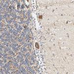 ACAT1 Antibody in Immunohistochemistry (Paraffin) (IHC (P))