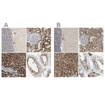ACAT1 Antibody in Immunohistochemistry (Paraffin) (IHC (P))