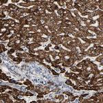 ACAT1 Antibody in Immunohistochemistry (Paraffin) (IHC (P))