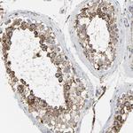 ACAT1 Antibody in Immunohistochemistry (Paraffin) (IHC (P))