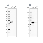 ACAT1 Antibody in Western Blot (WB)