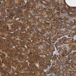 NDUFS3 Antibody in Immunohistochemistry (Paraffin) (IHC (P))