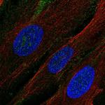 CD13 Polyclonal Antibody