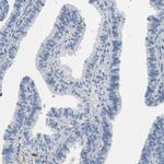 CD13 Antibody in Immunohistochemistry (Paraffin) (IHC (P))