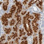 CD13 Antibody in Immunohistochemistry (Paraffin) (IHC (P))