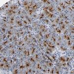CD13 Antibody in Immunohistochemistry (Paraffin) (IHC (P))