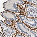 CD13 Antibody in Immunohistochemistry (Paraffin) (IHC (P))