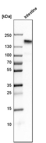CD13 Antibody in Western Blot (WB)