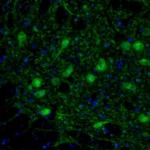 RhoGAP Antibody in Immunohistochemistry (Paraffin) (IHC (P))