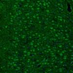 RhoGAP Antibody in Immunohistochemistry (Paraffin) (IHC (P))