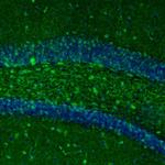 RhoGAP Antibody in Immunohistochemistry (Paraffin) (IHC (P))