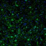 RhoGAP Antibody in Immunohistochemistry (Paraffin) (IHC (P))
