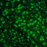 RhoGAP Antibody in Immunohistochemistry (Paraffin) (IHC (P))