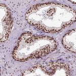 ZNF75D Antibody in Immunohistochemistry (Paraffin) (IHC (P))