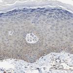 HMGCL Polyclonal Antibody