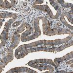 Talin 1 Antibody in Immunohistochemistry (Paraffin) (IHC (P))