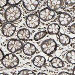 Talin 1 Antibody in Immunohistochemistry (Paraffin) (IHC (P))